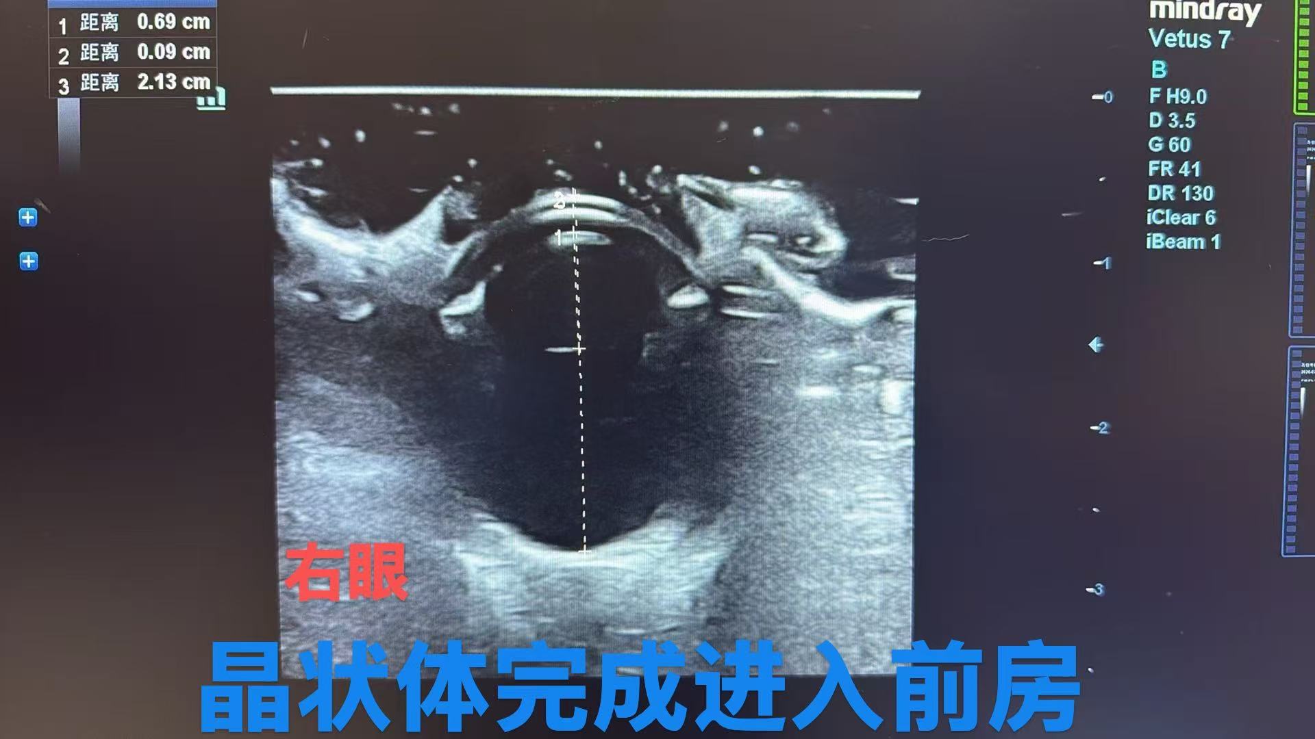 五邑地区动物眼科白内障手术怎么选？万信动物医院专科诊疗解析